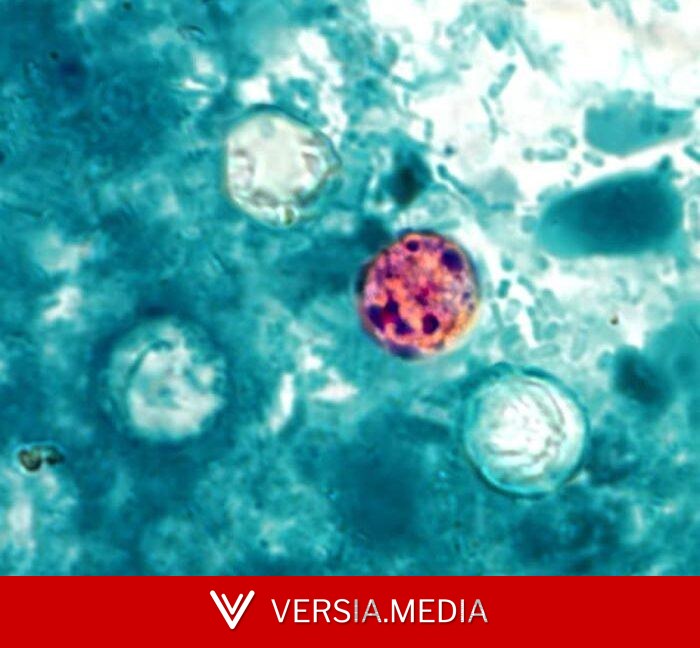 Michigan sees explosive outbreak of diarrheal parasite with over 700 cases